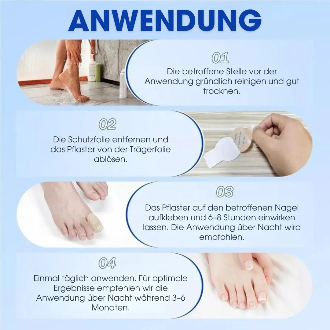 FUNGEX™ – Nagelpflaster gegen Nagelpilz