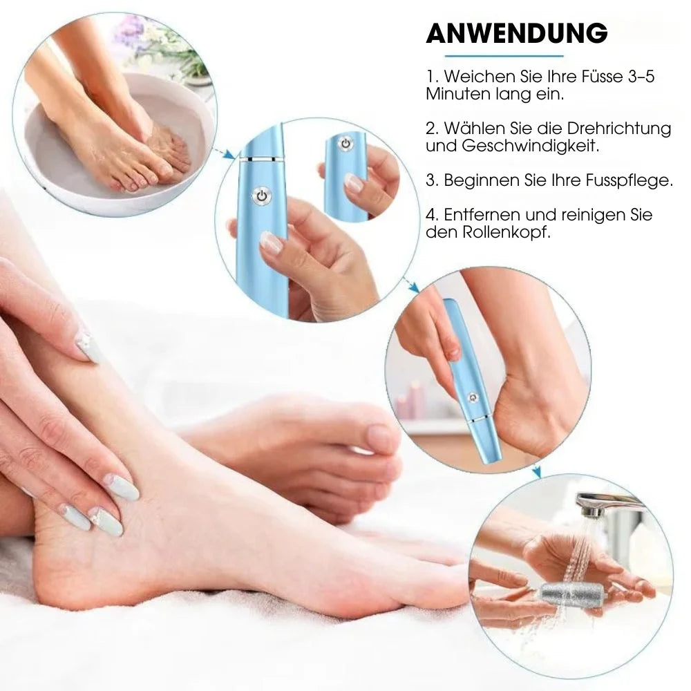 CalluCare™ – Elektrischer Hornhautentferner