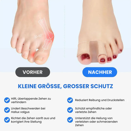 FlexiToe™ – Zehenspreizer & Hallux-valgus-Korrektor