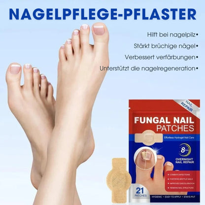 FUNGEX™ – Nagelpflaster gegen Nagelpilz