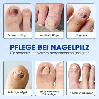 FUNGEX™ – Nagelpflaster gegen Nagelpilz