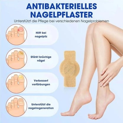FUNGEX™ – Nagelpflaster gegen Nagelpilz
