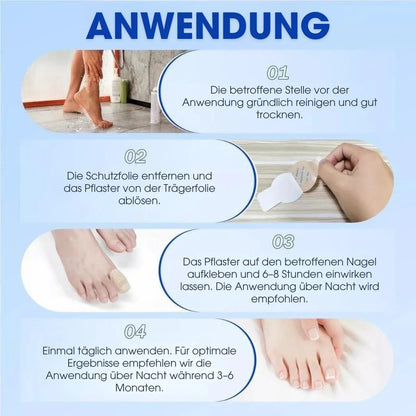 FUNGEX™ – Nagelpflaster gegen Nagelpilz
