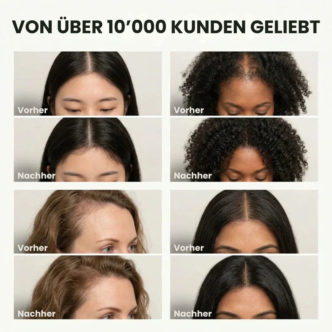 KoreRoot™ – Koreanische Shampoo-Bar für die Kopfhaut