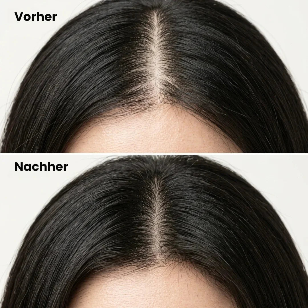 KoreRoot™ – Koreanische Shampoo-Bar für die Kopfhaut
