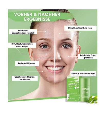 TeaMask® – Tiefenreinigende Grüntee-Maske